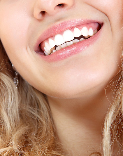 Partial Dentures