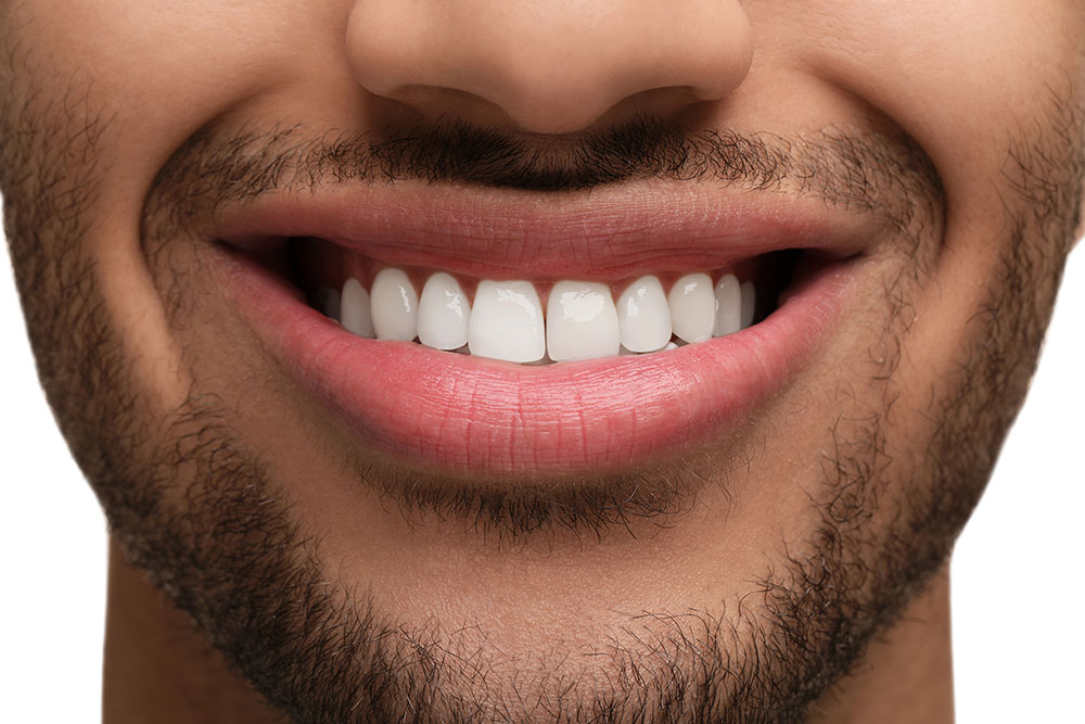 What Is the Difference Between Veneers and Crowns