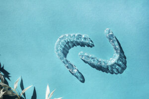 How Do Clear Aligners Compare to Traditional Braces